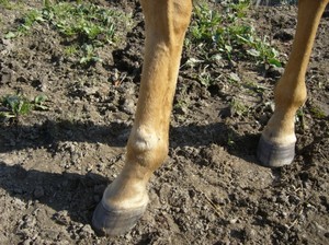 Beb� u� m�me zahojen�.